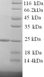 SDS-PAGE