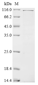 SDS-PAGE