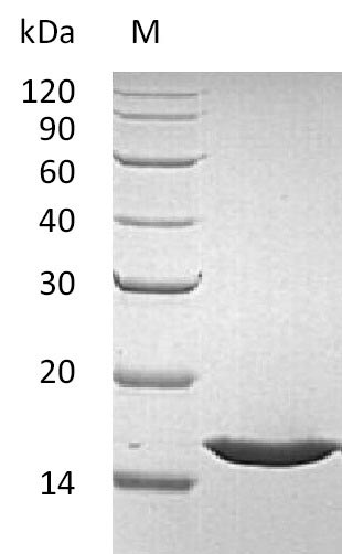 SDS-PAGE
