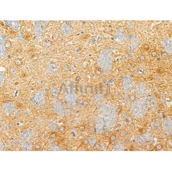 Валидация Affinity AF4081 - 2141