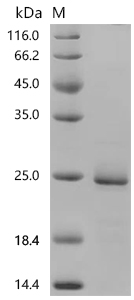 SDS-PAGE