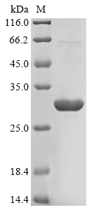 SDS-PAGE