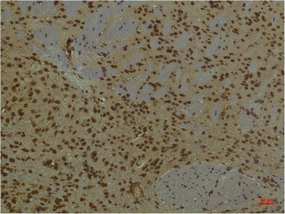 Иммуногистохимия, PI 3 kinase p85 alpha, ткань мозга мыши