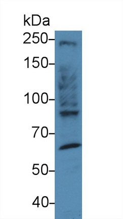 13944
