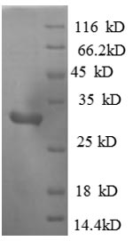 SDS-PAGE