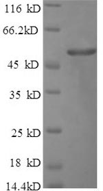 SDS-PAGE