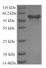 SDS-PAGE