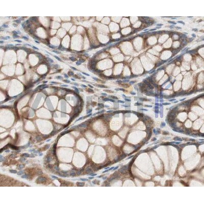 Валидация Affinity AF5104 - 2458