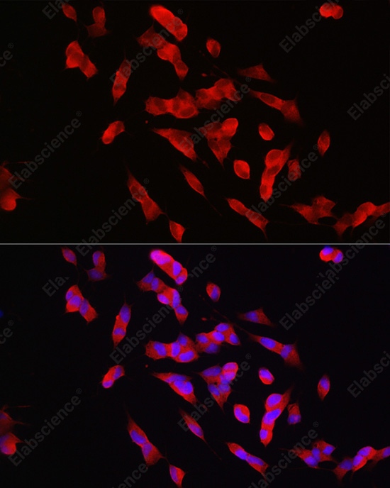 Иммунофлуоресценция, PTPN5, клетки SH-SY5Y