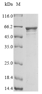 SDS-PAGE