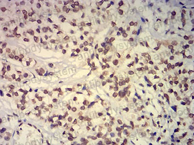 Валидация AntibodySystem RHK57201 (3704)