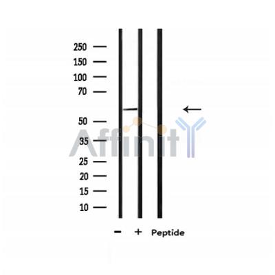 Валидация Affinity AF6362 - 3655