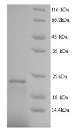 SDS-PAGE