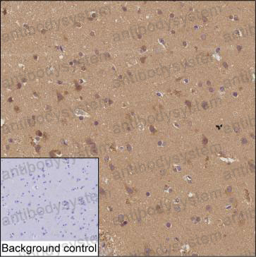 Валидация AntibodySystem RHD82001