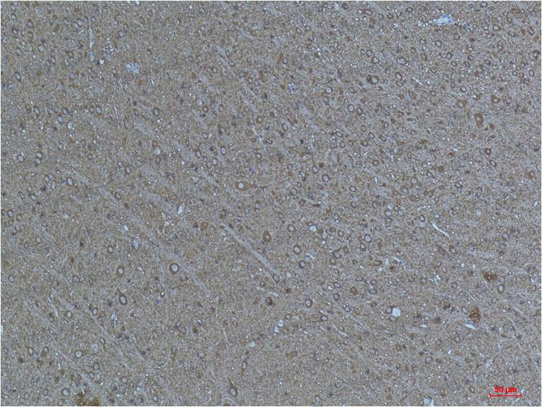 Валидация AntibodySystem RHF62206