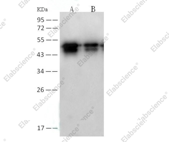 Вестерн-блоттинг, SARS-CoV Nucleoprotein/NP, рекомбинантный белок