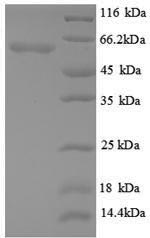 SDS-PAGE