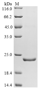 SDS-PAGE