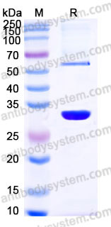 YHC83302, SDS-PAGE