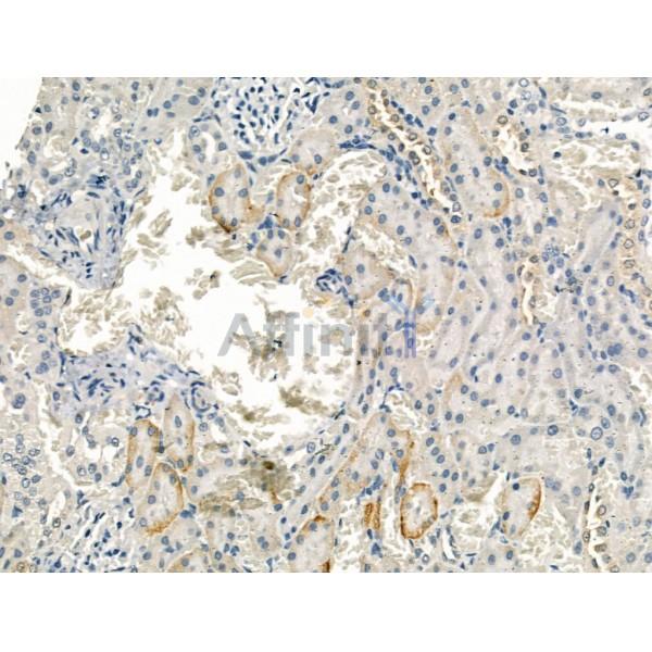 Валидация Affinity DF13231 - 8273