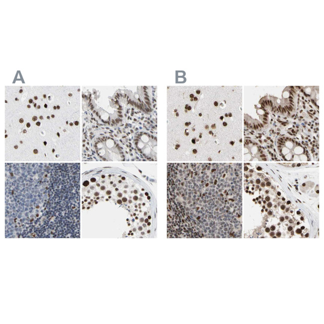 Валидация AssayVector ARM1638(1774)