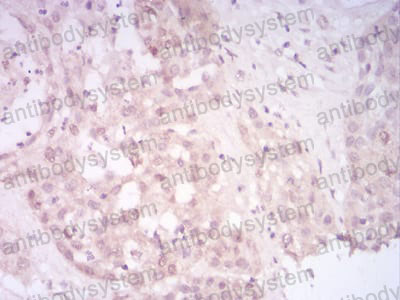 Валидация AntibodySystem RHJ65802 (3504)