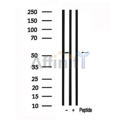 Валидация Affinity AF7641 - 4316