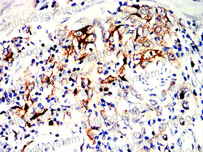 Валидация AntibodySystem RHM00904 (3762)