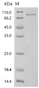 SDS-PAGE