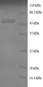 SDS-PAGE