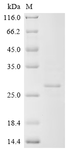 SDS-PAGE