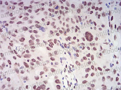 Валидация AntibodySystem RHK75502