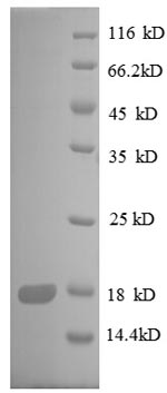 SDS-PAGE
