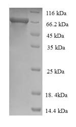 SDS-PAGE