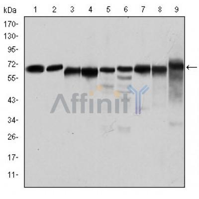 Валидация Affinity BF9215 - 5431
