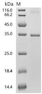 SDS-PAGE