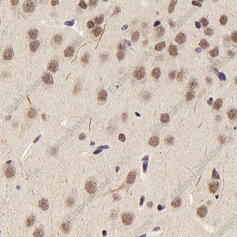 Иммуногистохимия, HDAC1, ткань мозга крысы