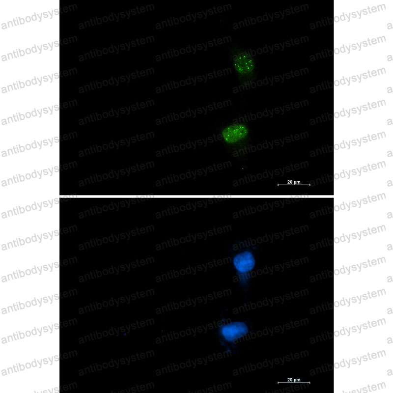 Валидация IF - AntibodySystem RHD10502