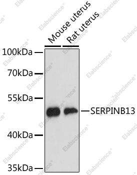 Вестерн-блоттинг, SERPINB13, различные клеточные линии