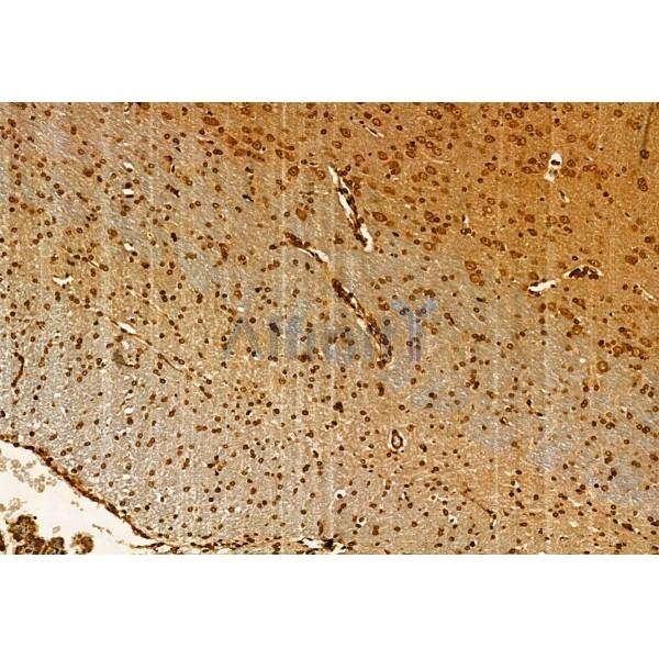 Валидация Affinity DF6428 - 17804