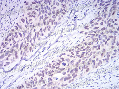 Валидация AntibodySystem RHJ91403