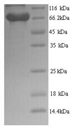 SDS-PAGE