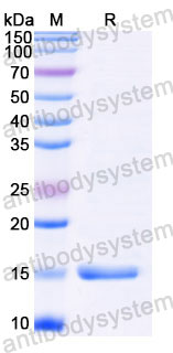 Валидация SDS-PAGE - AntibodySystem RXX00904