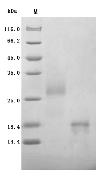 SDS-PAGE