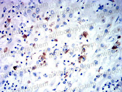 Валидация AntibodySystem RHE58401 (2230)