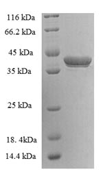 SDS-PAGE