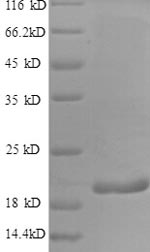 SDS-PAGE