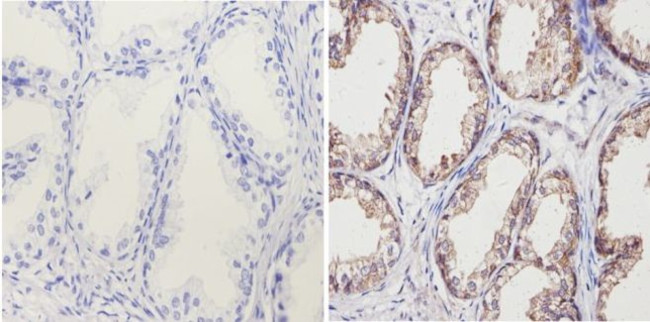 Валидация AssayVector ARM1162(451)