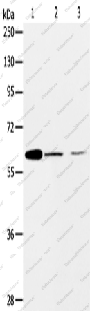 Вестерн-блоттинг, ABCE1, клетки NIH/3T3 и SKOV3, ткань рака яичника человека