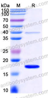 YHJ30701, SDS-PAGE